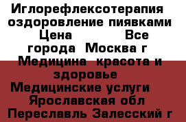 Иглорефлексотерапия, оздоровление пиявками › Цена ­ 3 000 - Все города, Москва г. Медицина, красота и здоровье » Медицинские услуги   . Ярославская обл.,Переславль-Залесский г.